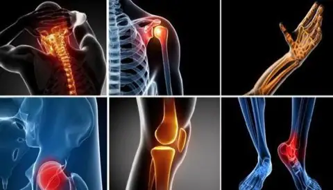orthopedics